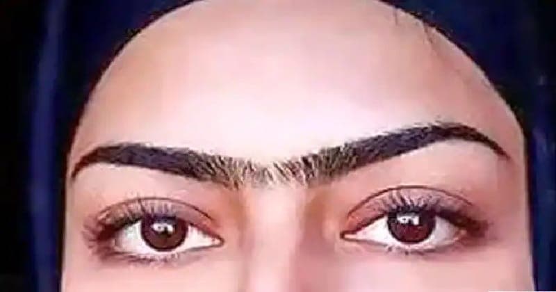JOINT EYEBRO