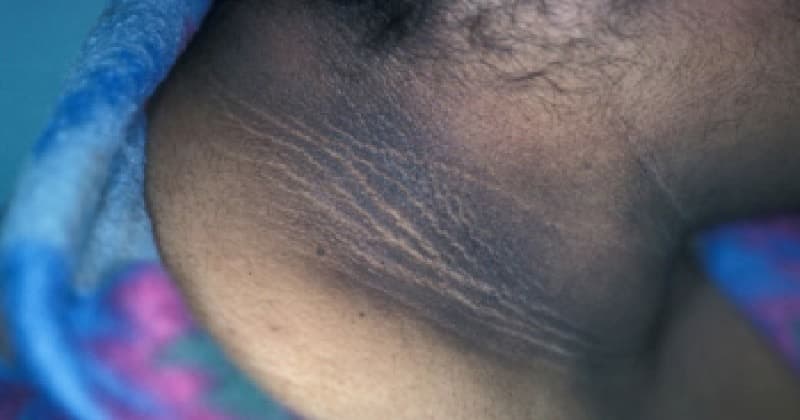 Black Neck